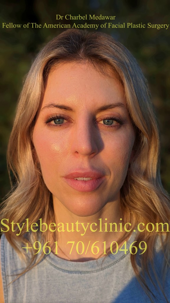 doctor charbel medawar blepharoplasty surgery
