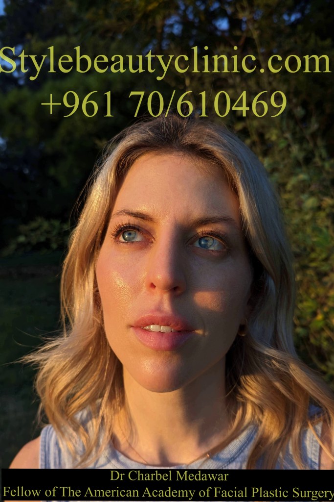 doctor charbel medawar blepharoplasty surgery