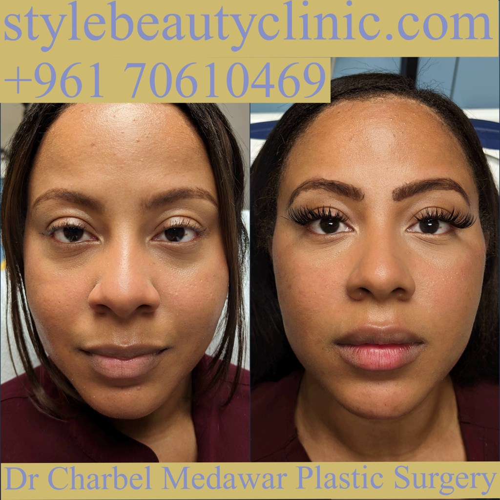 dr charbel medawar style beauty clinic cosmetics lebanon