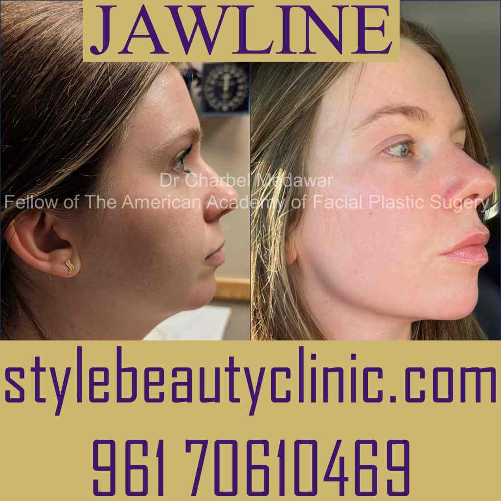 plastic surgeons in lebanon