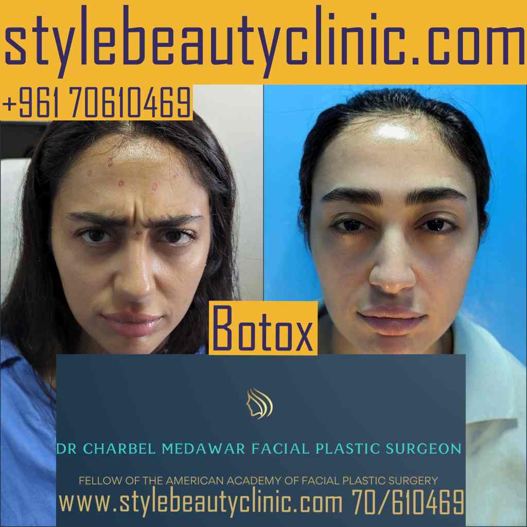 top aesthetic surgeries in lebanon