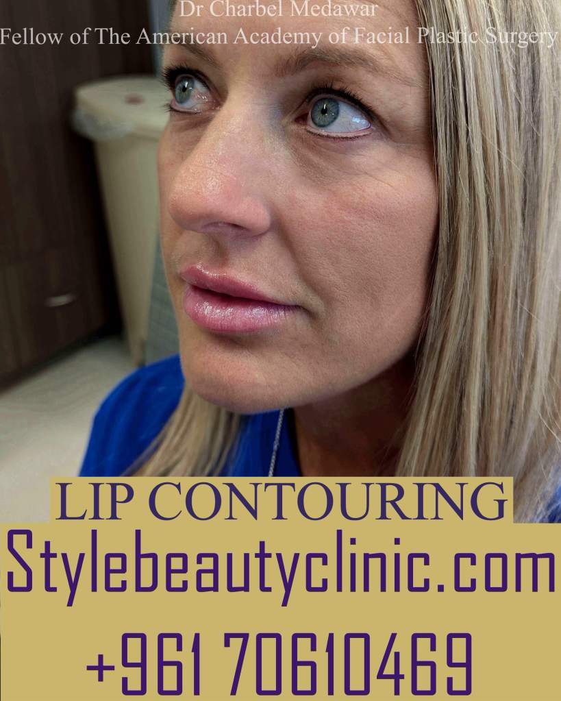 best cosmetic lip fillers lebanon dr charbel medawar