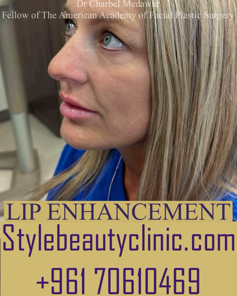 best lip fillers enhancement contouring lebanon dr charbel medawar