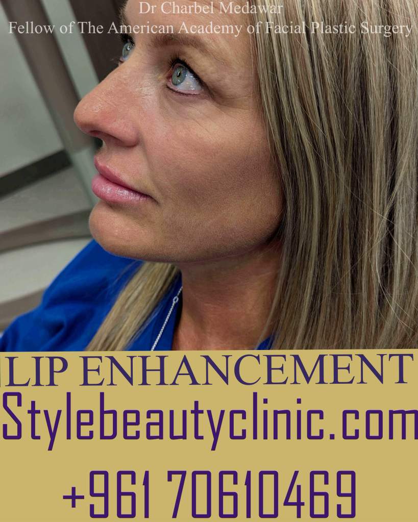 best natural lip fillers contouring lebanon dr charbel medawar