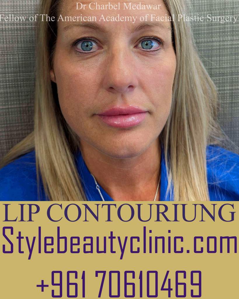 best natural lips fillers contouring lebanon dr charbel medawar
