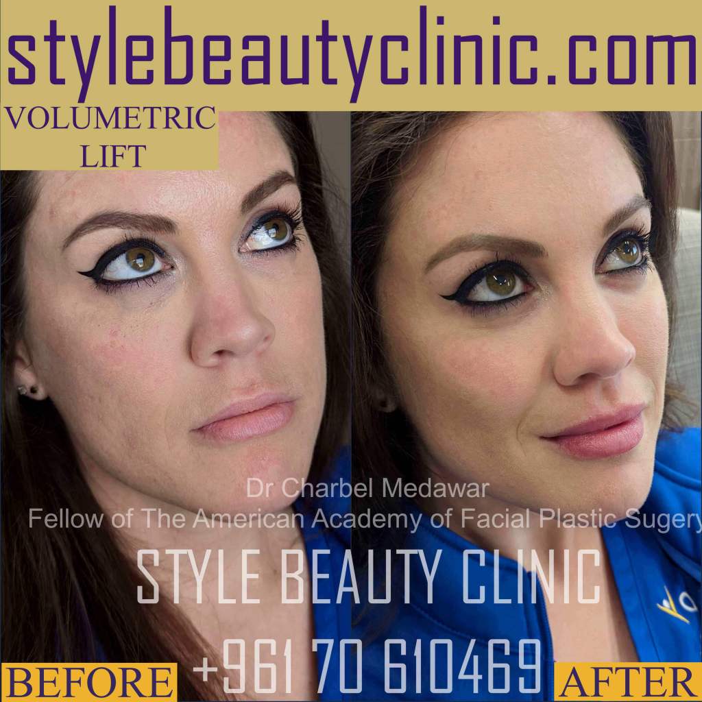 best plastic cosmetic surgeon in lebanon dr charbel medawar