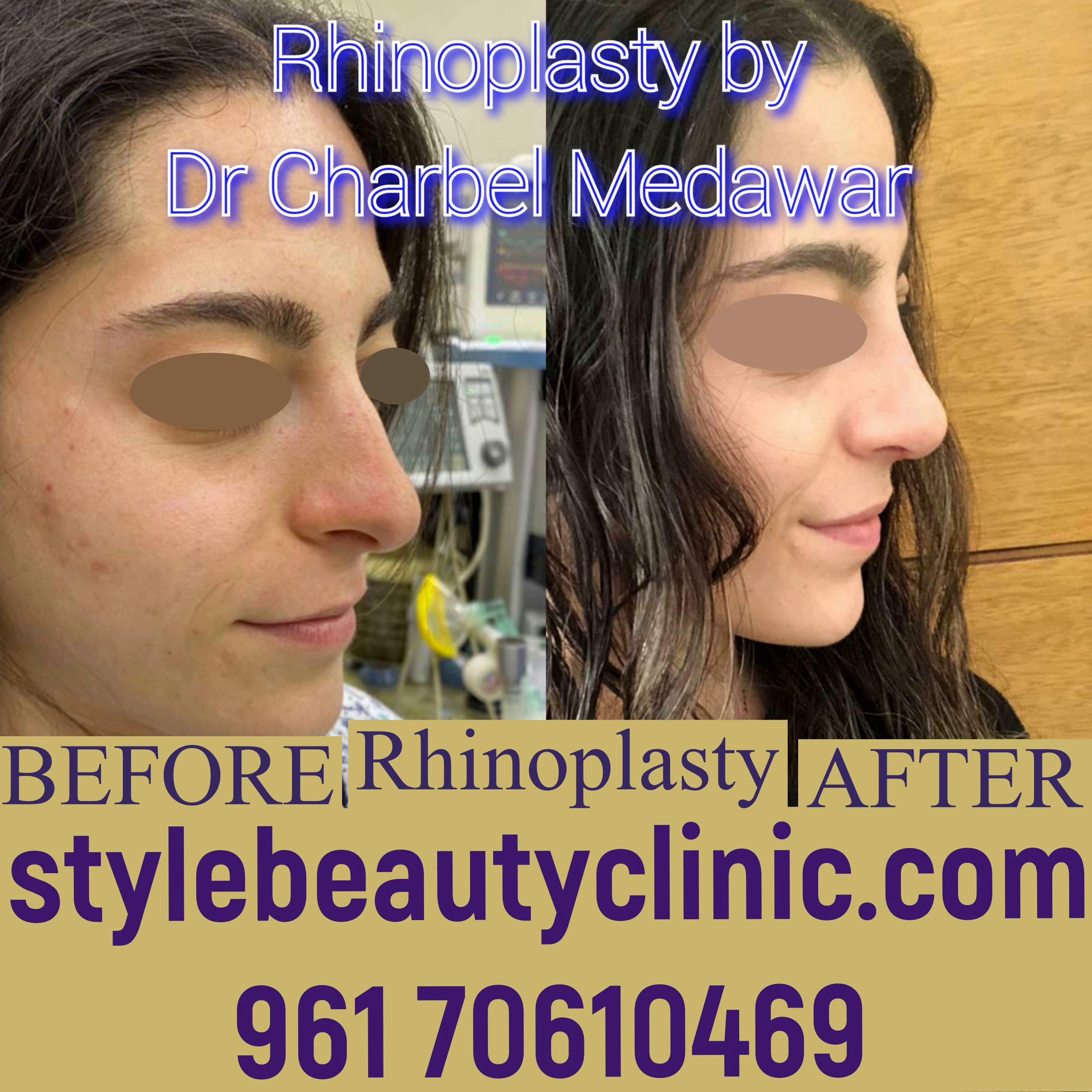 dr charbel medawar number 1 plastic surgeon in lebanon