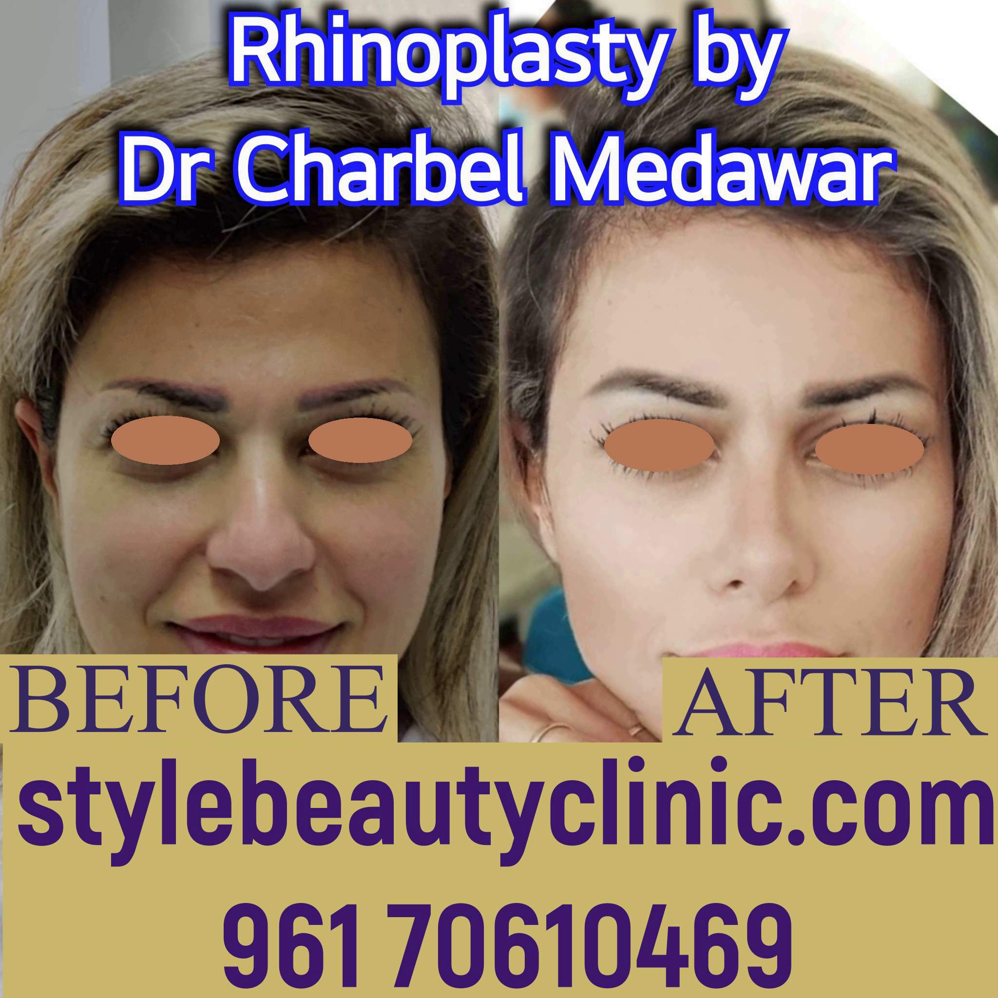 dr charbel medawar style beauty clinic best plastic surgeon middle east