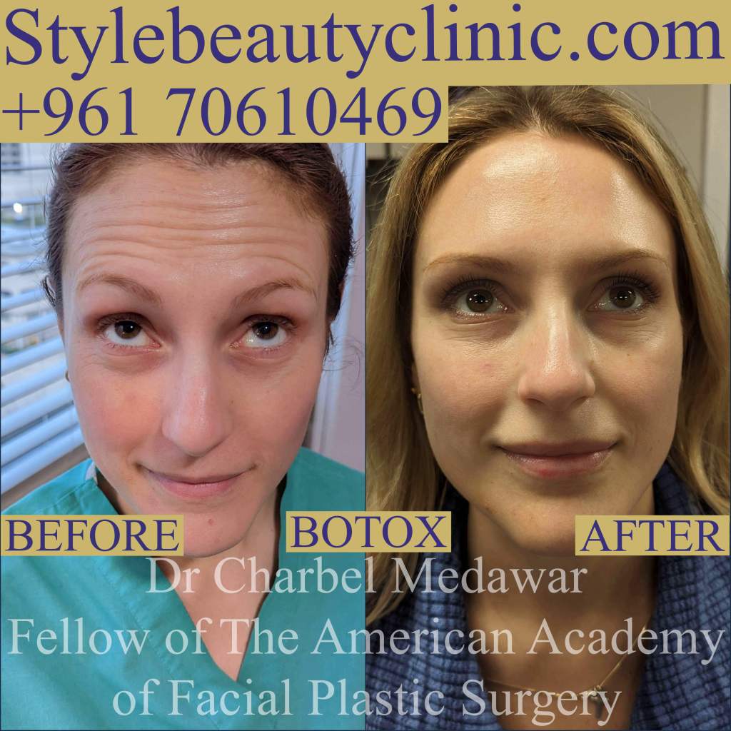 dr charbel medawar style beauty clinic botox beauty