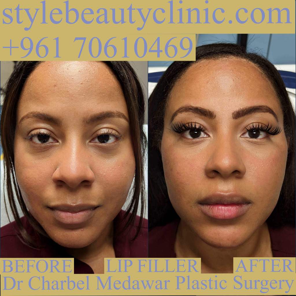 dr charbel medawar style beauty clinic cosmetics lebanon