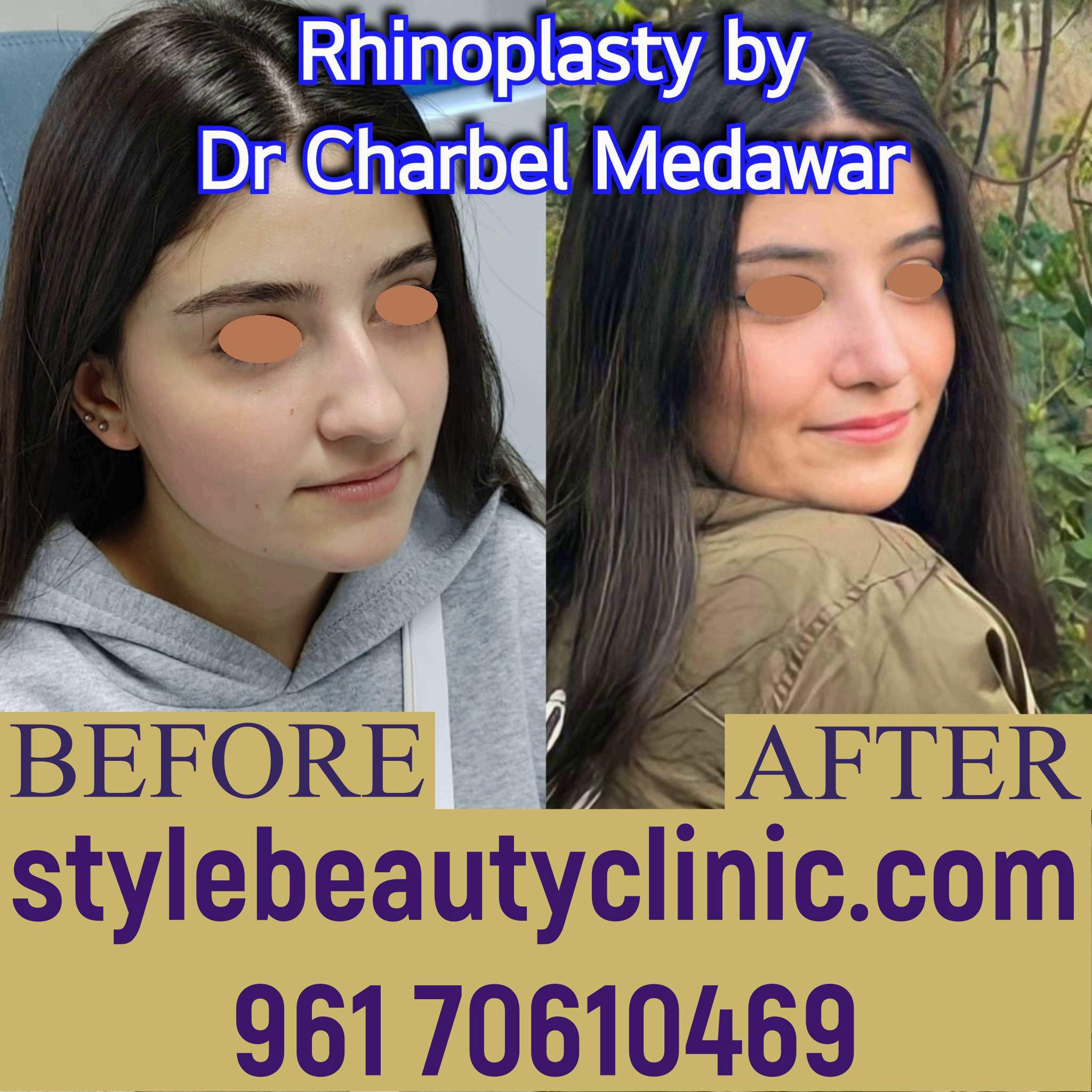 dr charbel medawar style beauty clinic natural nose plastic surgery lebanon