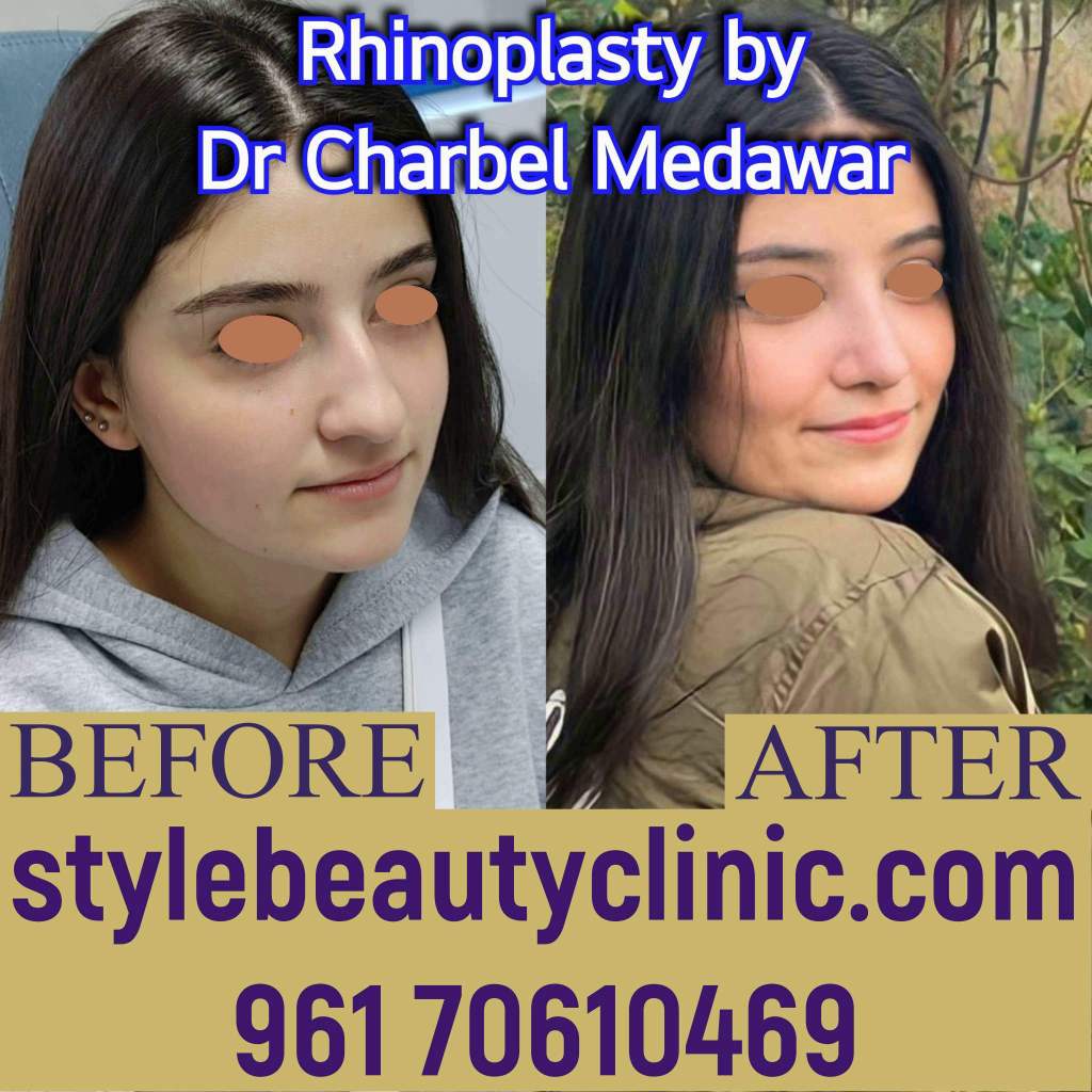 dr charbel medawar style beauty clinic natural nose plastic surgery lebanon