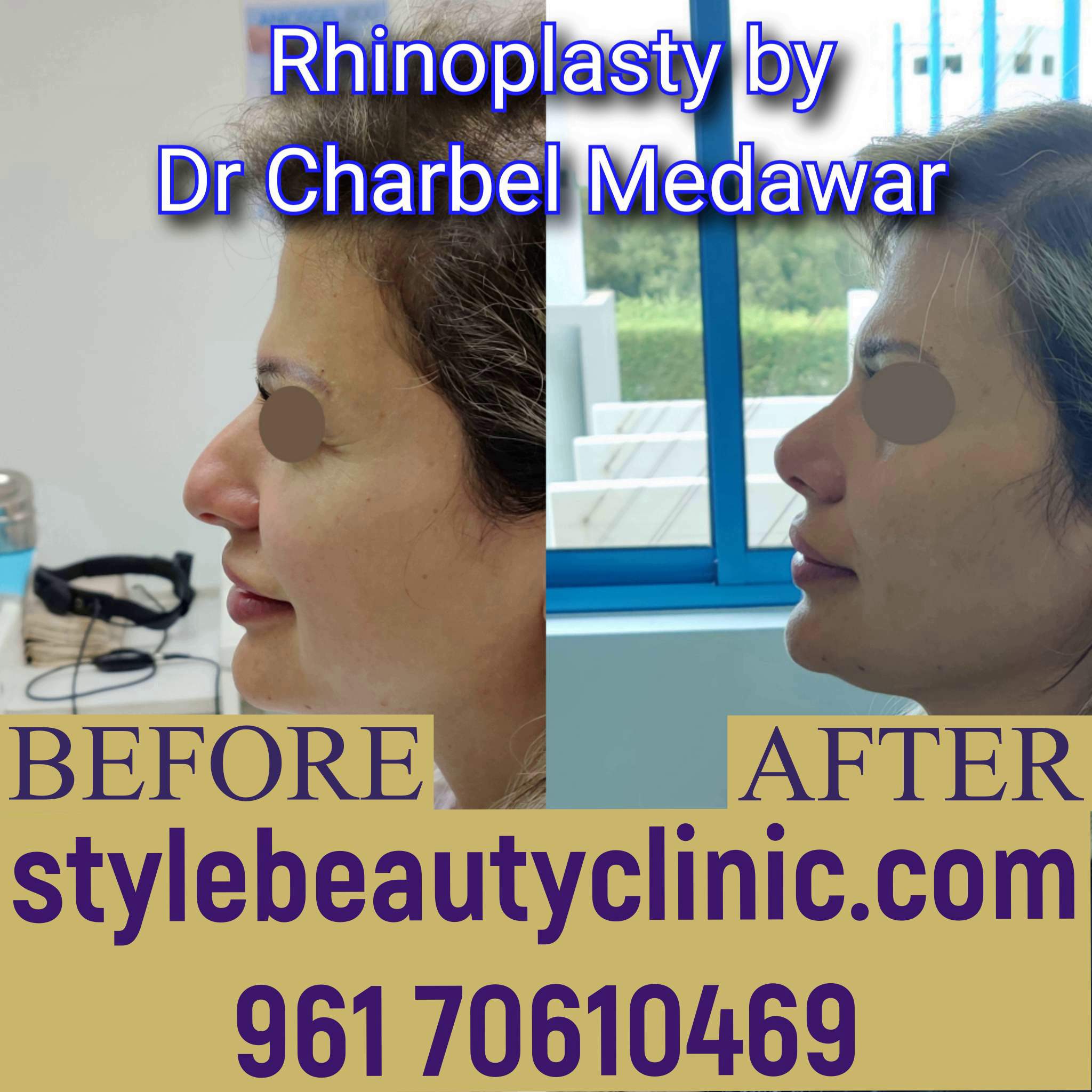 dr charbel medawar style beauty clinic plastic surgery