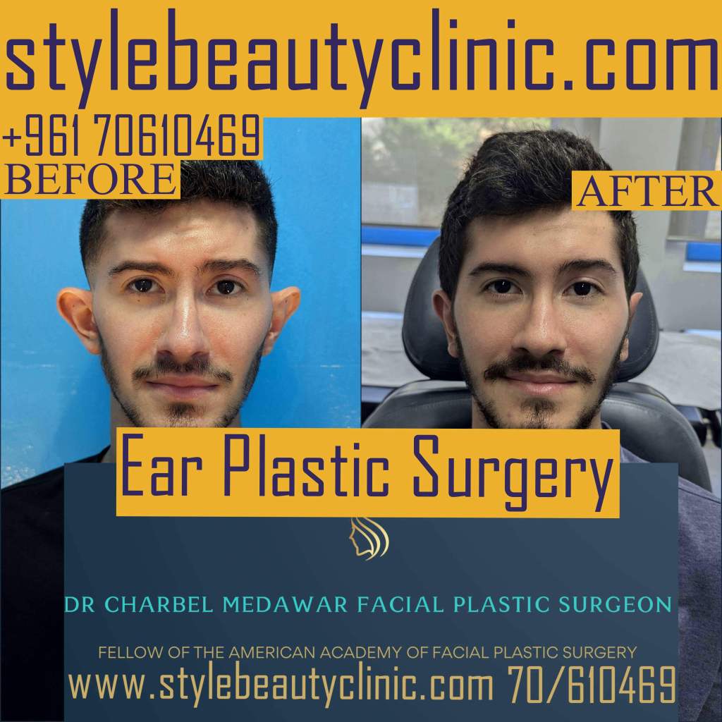 ear plastic surgery lebanon dr charbel medawar