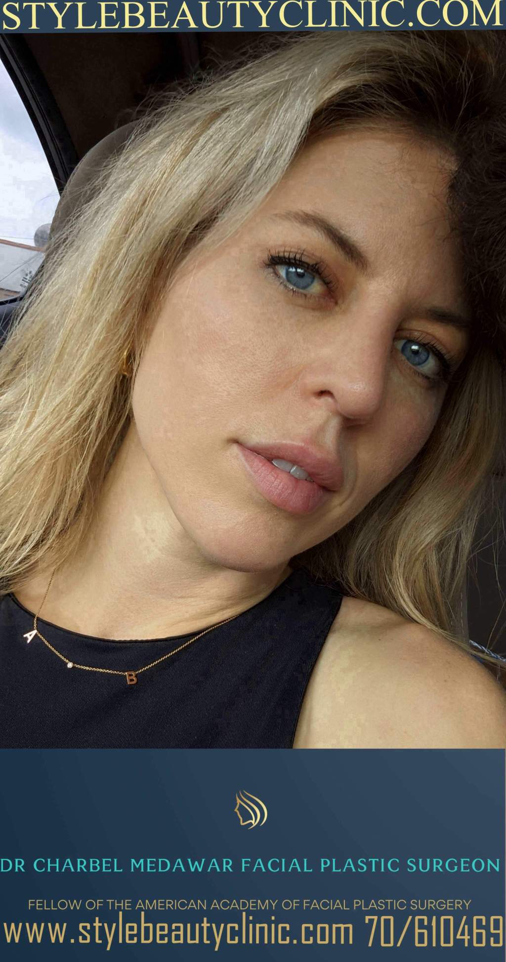 charbel medawar patient satisfaction