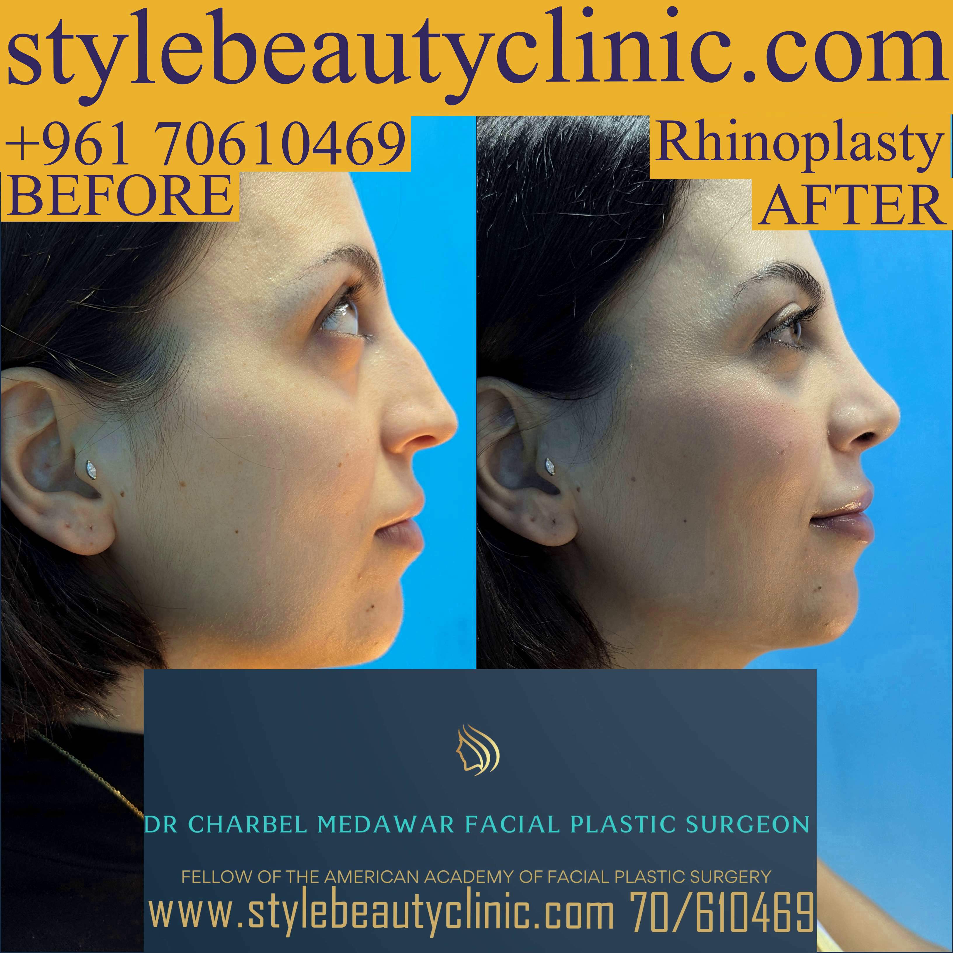 leading plastic surgeon lebanon dr charbel medawar