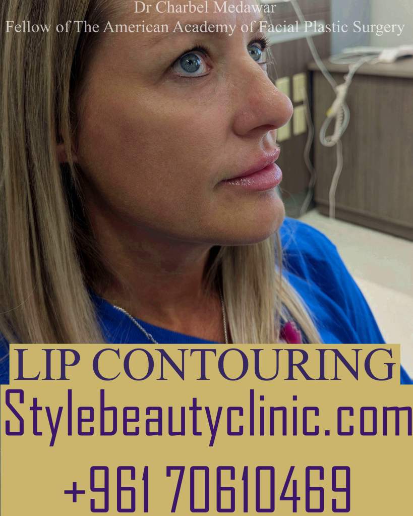 top natural lip fillers lebanon dr charbel medawar
