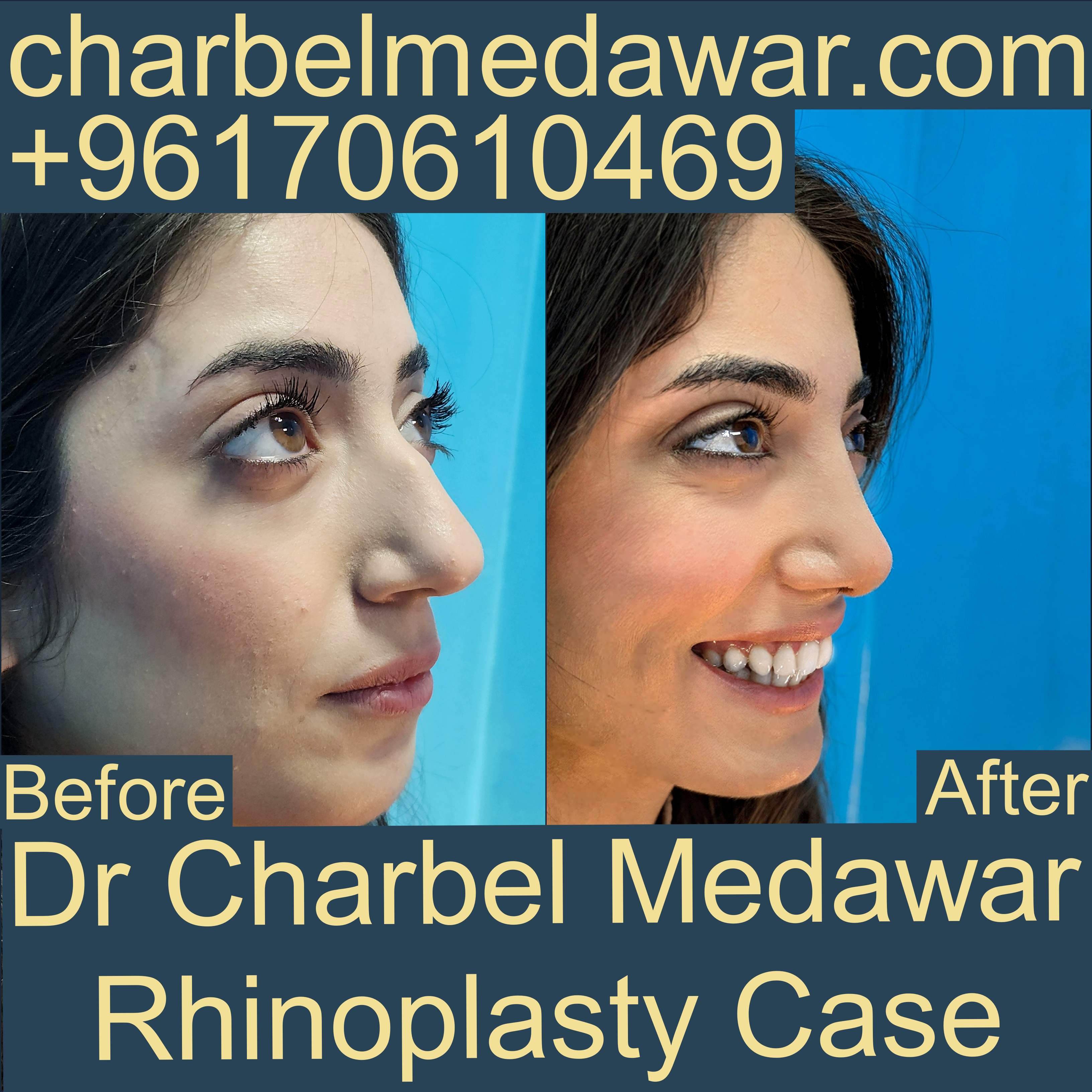 most trusted surgeon in lebanon dr charbel medawar