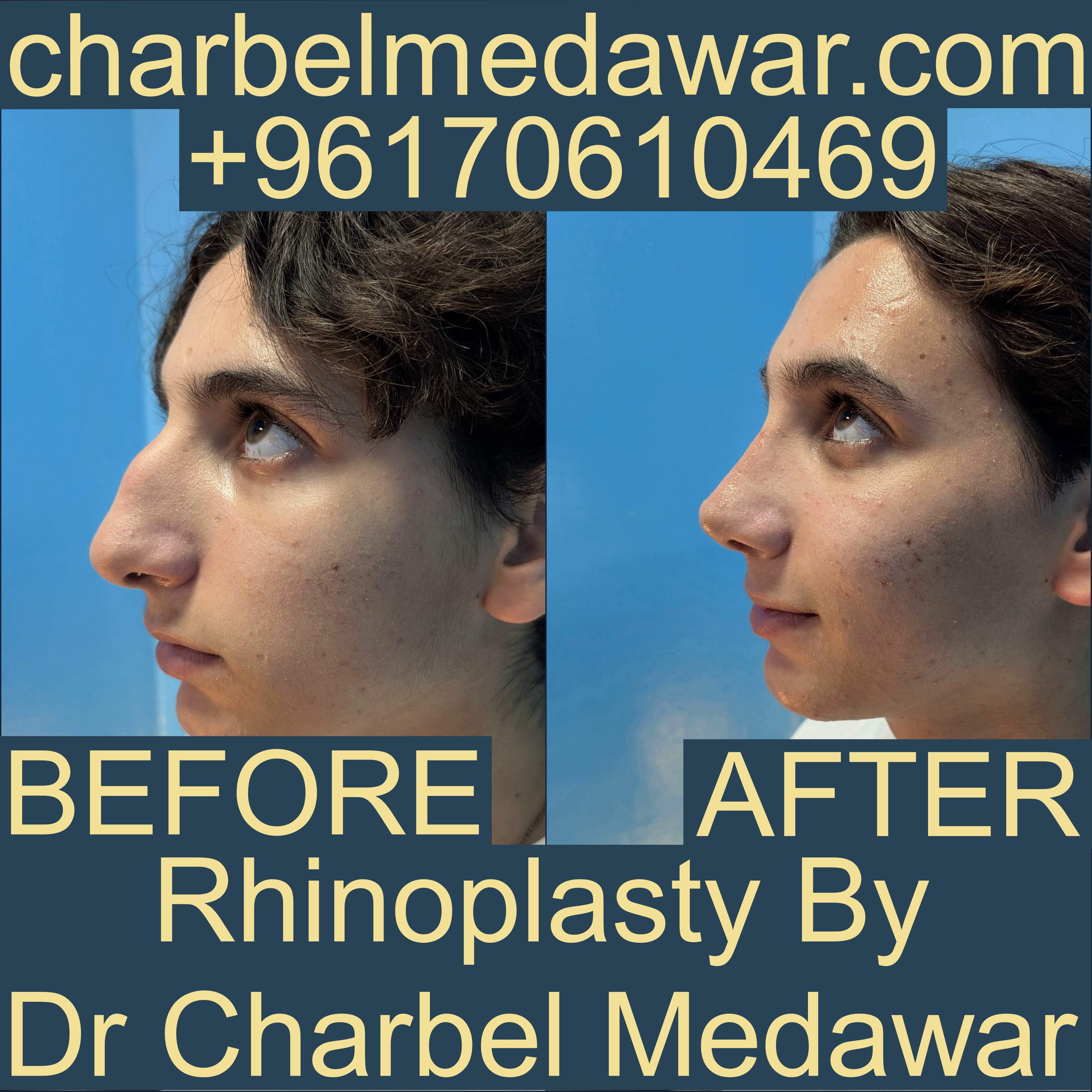 أفضل جراح تجميل في لبنان