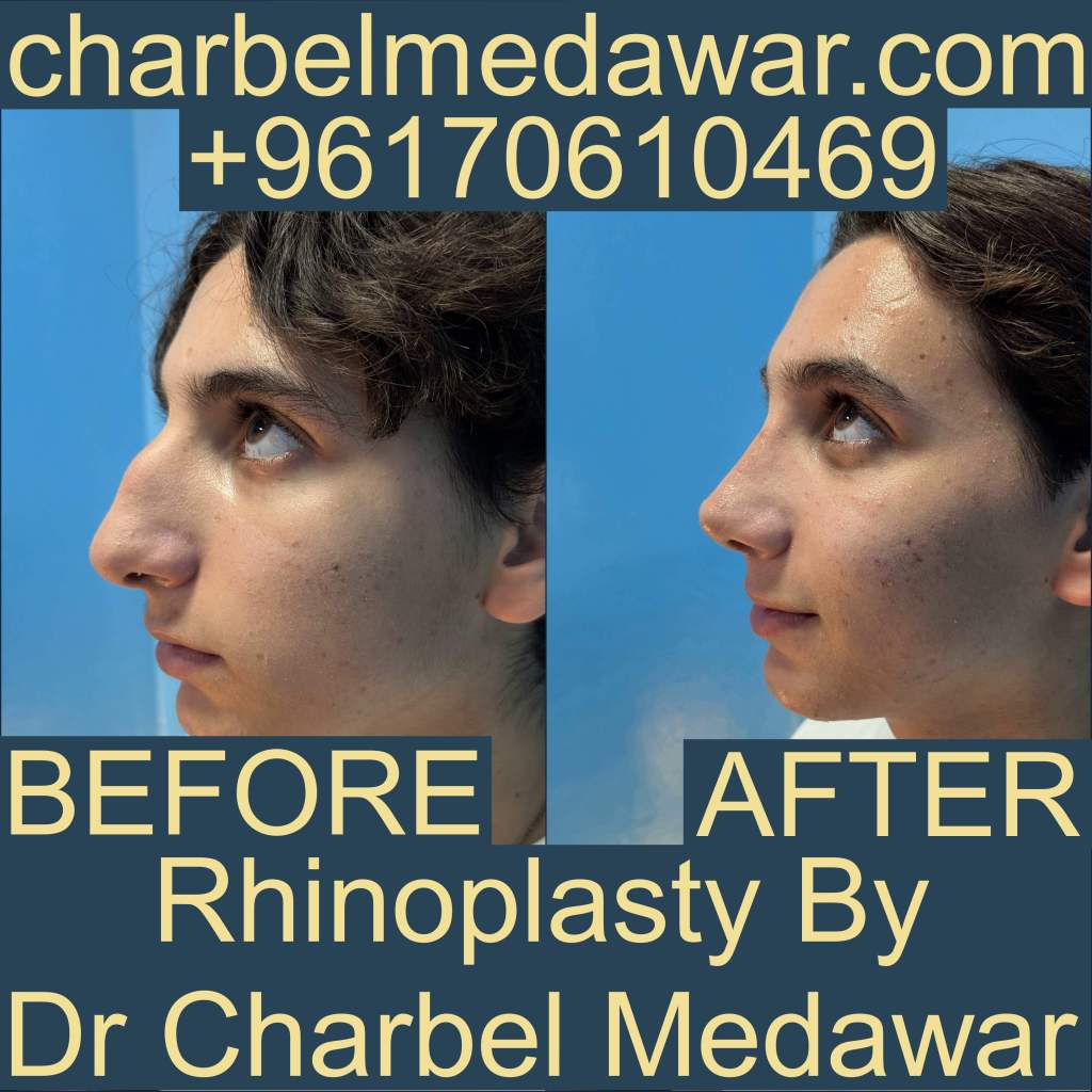 أفضل جراح تجميل في لبنان