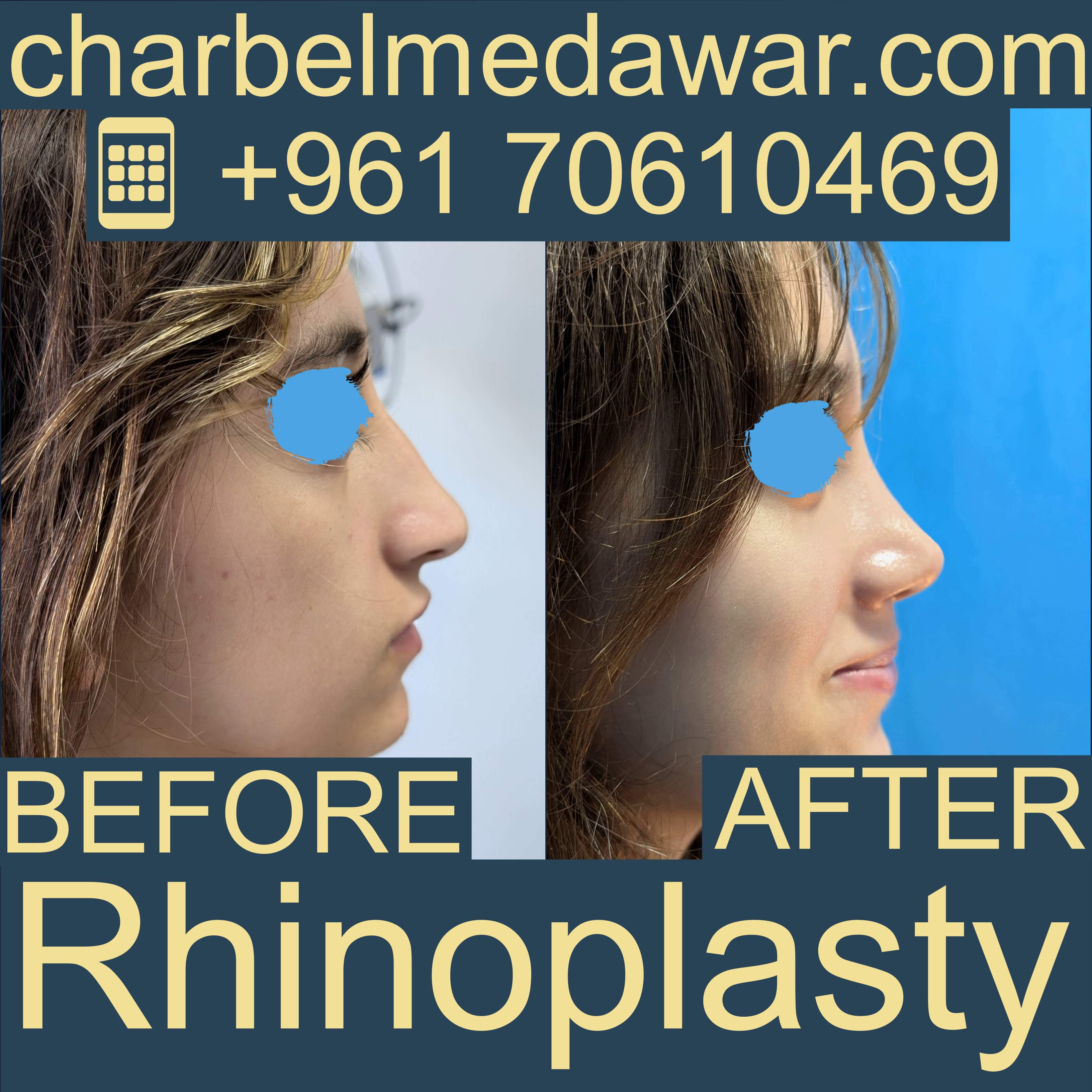 أفضل جراح تجميل في لبنان