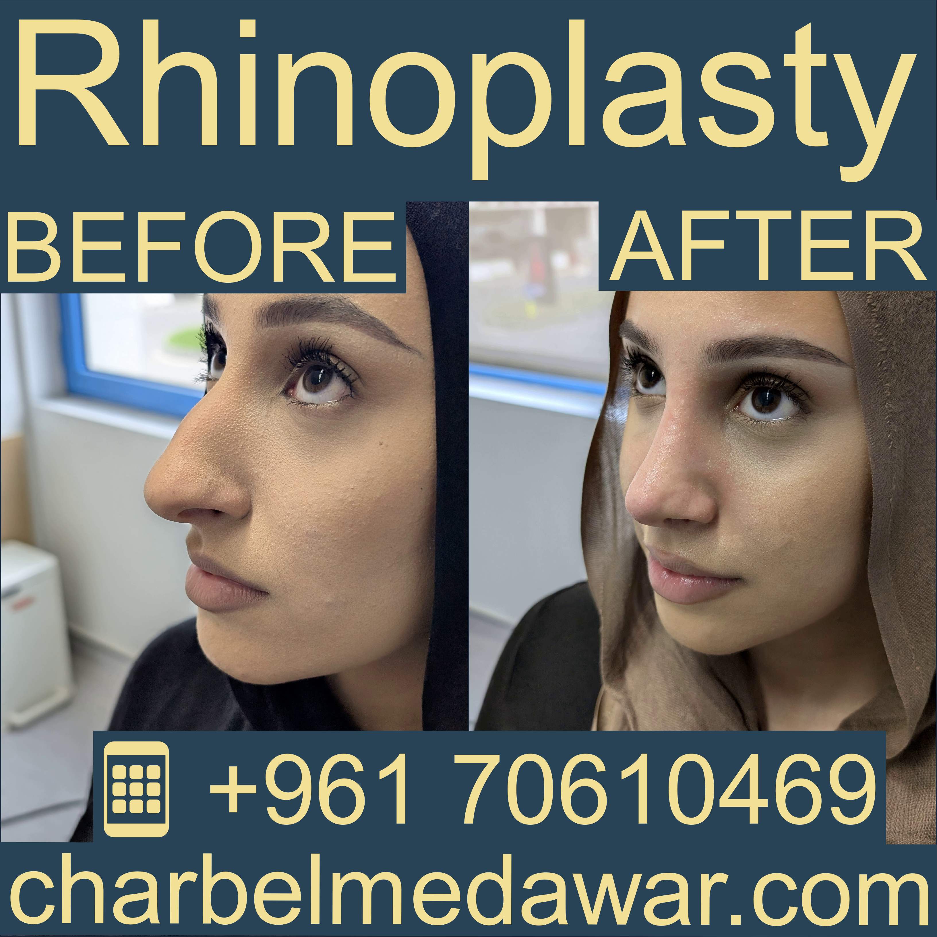 أفضل جراح تجميل موثوق في لبنان