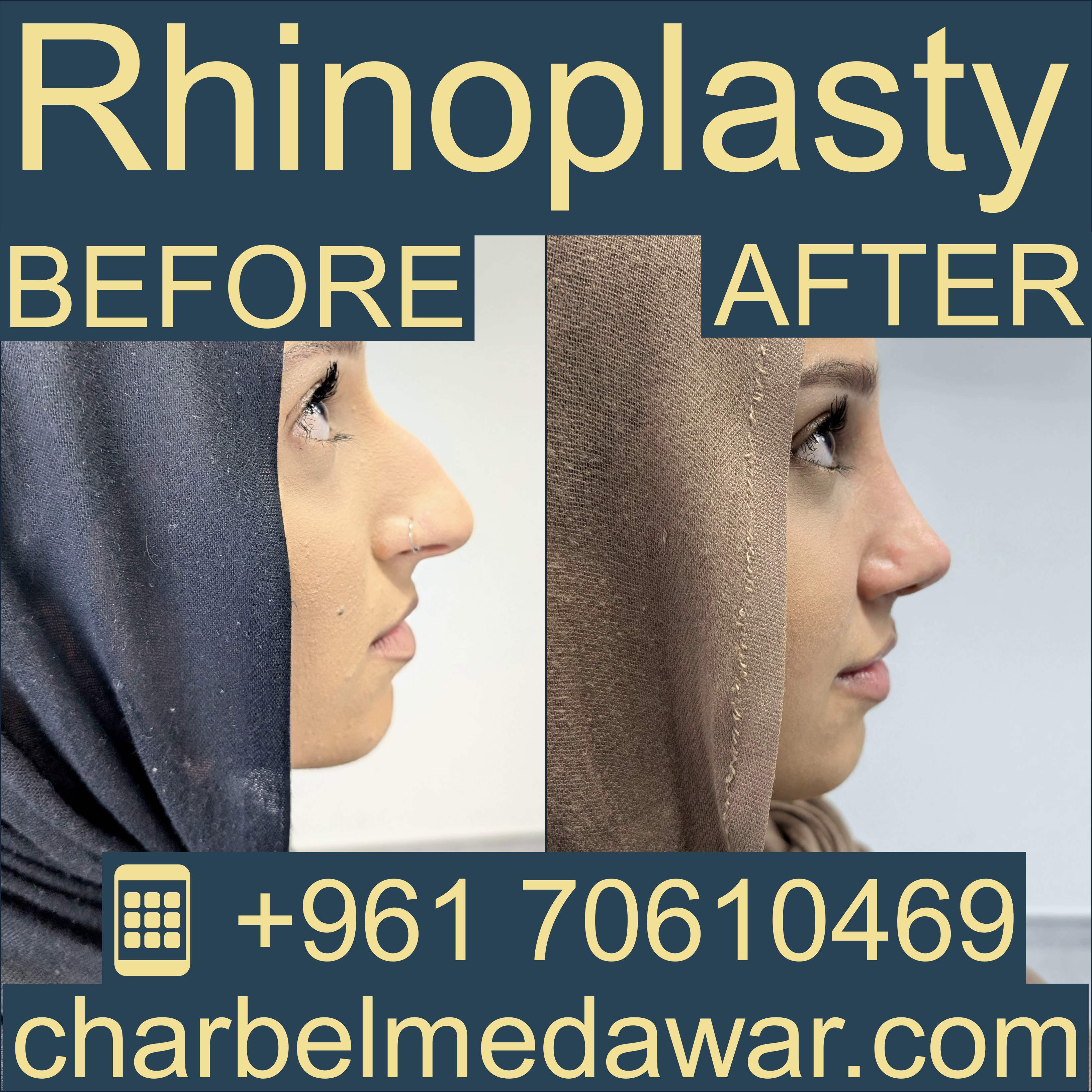 دكتور شربل مدور أشهر جراح تجميل في الشرق الأوسط