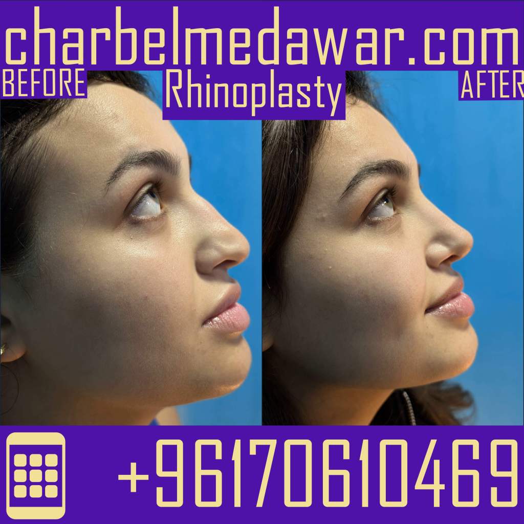 best plastic surgeon lebanon charbel medawar