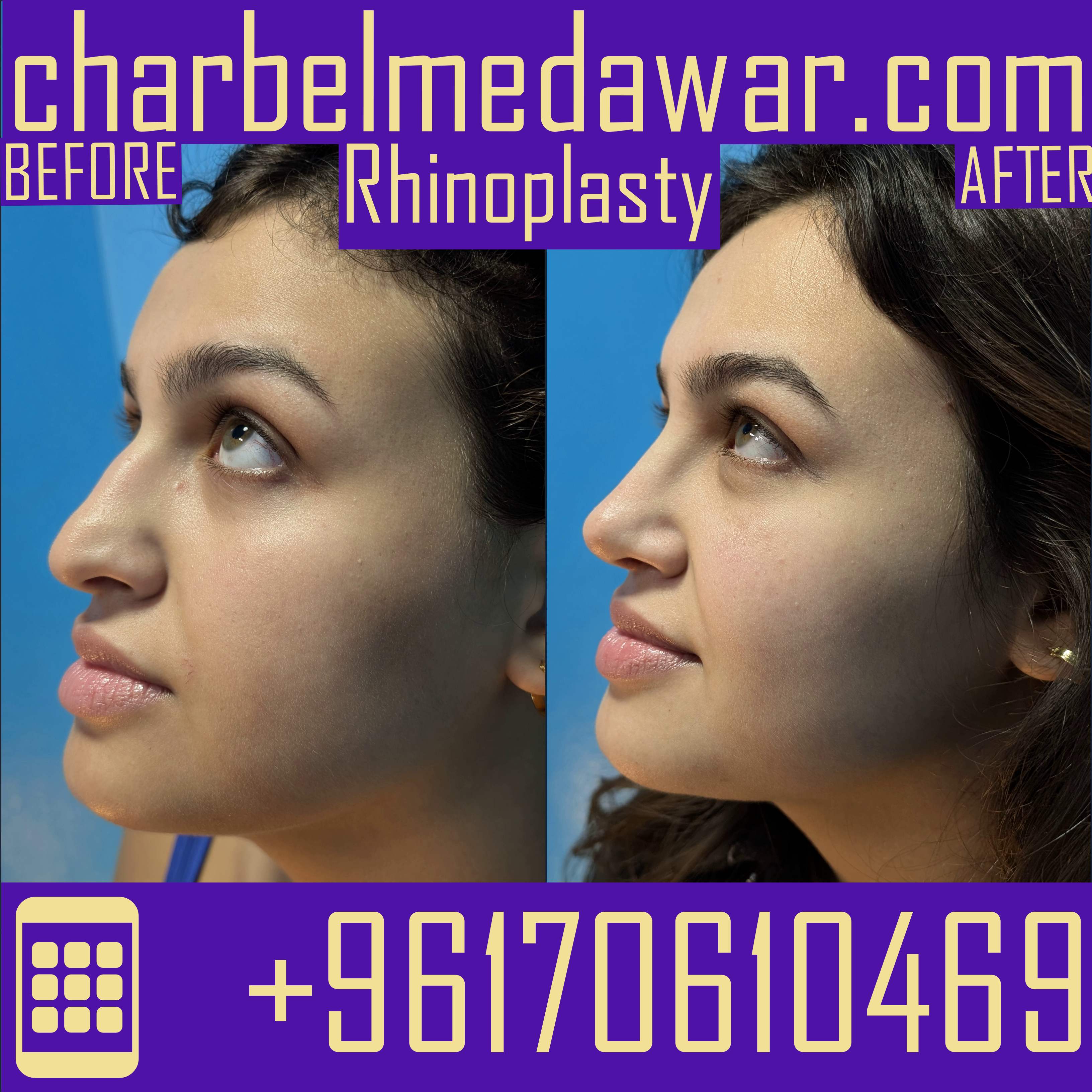 lebanon plastic surgery