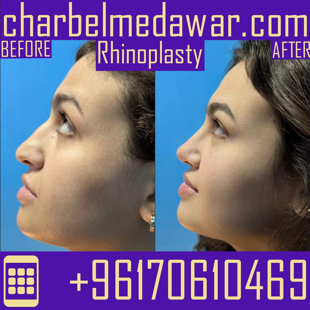 PLASTIC SURGERY LEBANON