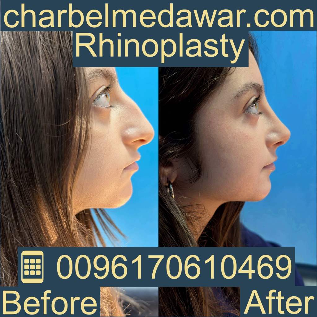 Lebanon medical tourism plastic surgery